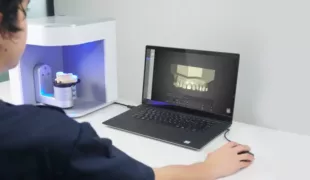 Medit Laborscanner der T-Serie im Einsatz – eine Patentverletzungsklage von Mitbewerber 3Shape bezüglich einer computerimplementierten Methode zum Designen eines Zahnstiftaufbaus wurde nun abgewiesen.