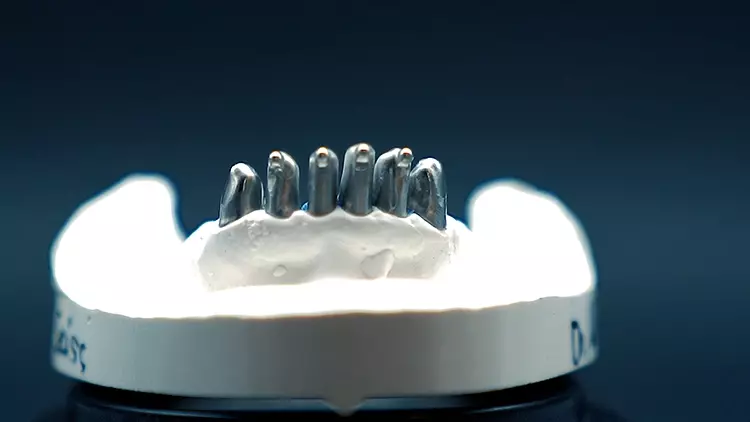 Abb. 4. Die glänzenden Flächen (Abb. 1 bis 4) wurden gleichmäßig mit dem Scanninspray Scantist 3D mattiert. Nach ca. 20 Minuten sublimiert die aufgetragene Schicht. Damit ist keine Reinigung erforderlich.