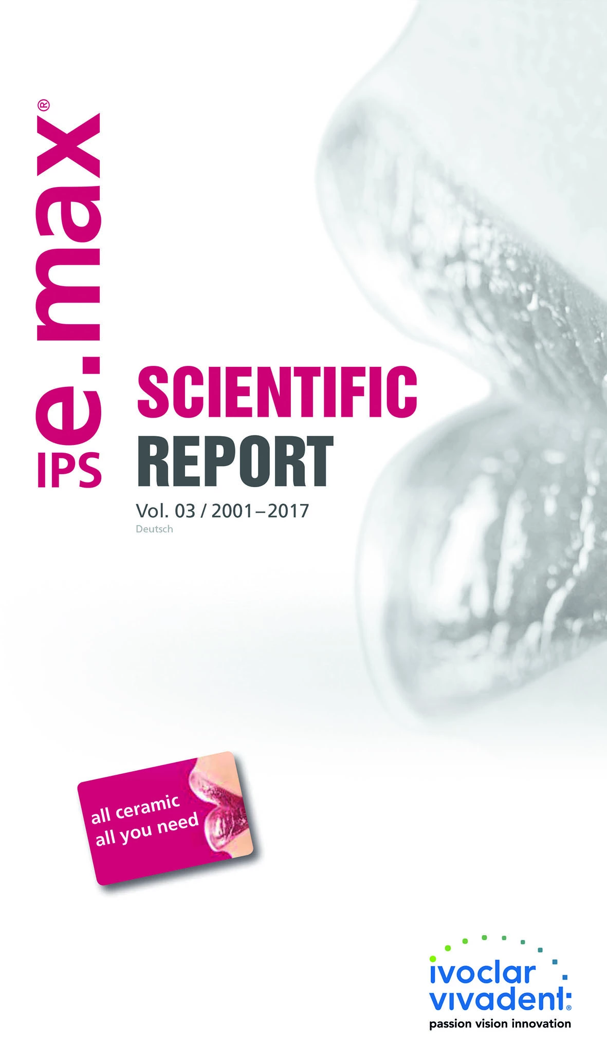 Der IPS e.max Scientific Report liefert eine Zusammenfassung der wichtigsten In-vivo- und In-vitro-Studienergebnisse aus den Jahren 2001 bis 2017.