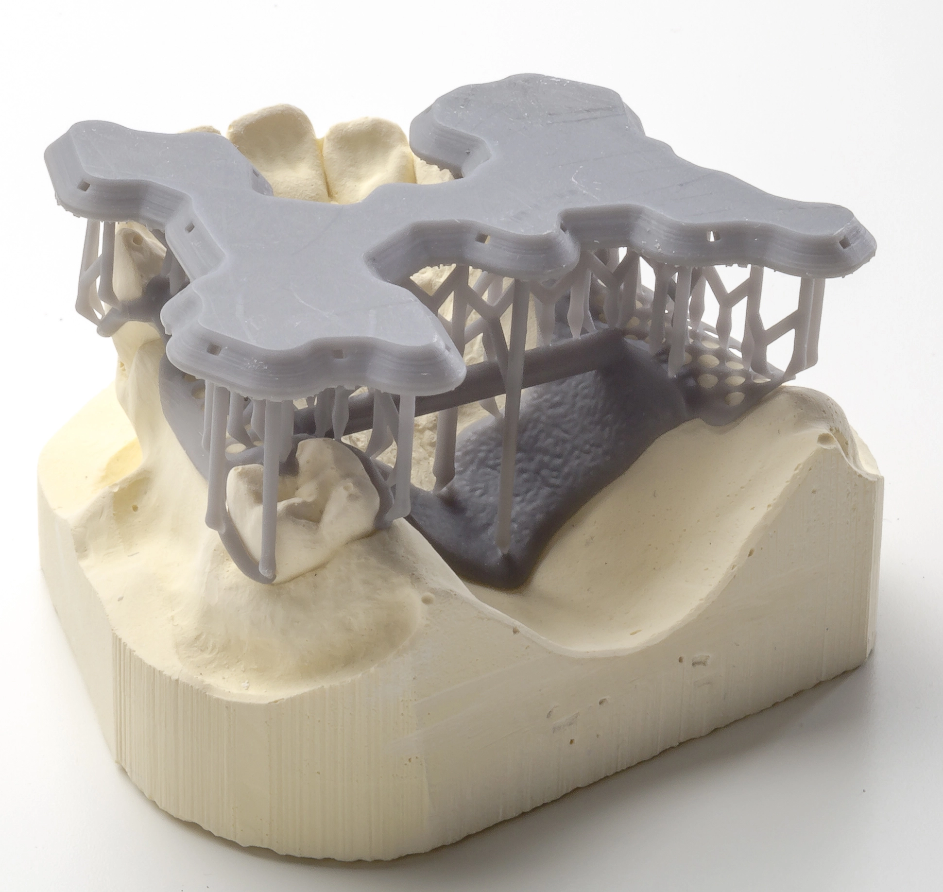 Abb. 17b: ...noch mit Supports.