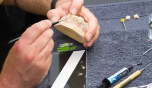 Ästhetisches Finish: Mit einer ruhigen Hand und den Signum Verblendkompositen erzielen Zahntechniker eine authentische Oberflächenstruktur.