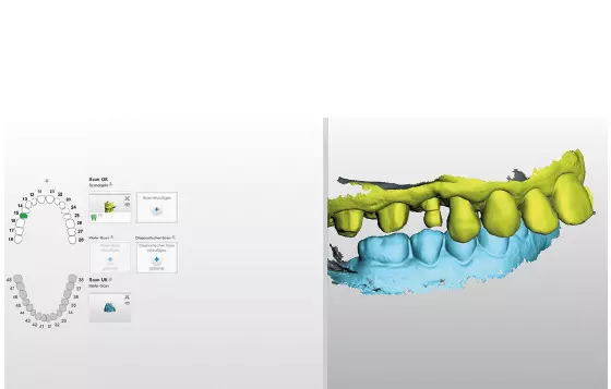 Abb. 30: Verschiedene Datenübertragungswege sind möglich. Praktisch ist der direkte „Upload“ des Scandatensatzes ohne weitere Umwege (z. B. Atlantis von Dentsply Sirona, dies ist allerdings nur mit den IO FLO der Firma möglich).