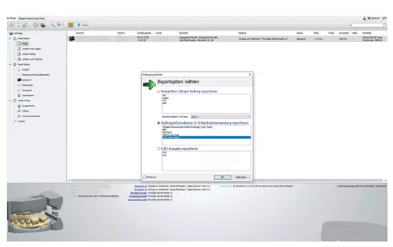 Abb. 31: Weiteres Beispiel: Export eines Datensatzes (meistens im STL-Format) eines selbst konstruierten Abutments aus der 3Shape-Software an das Fräszentrum.