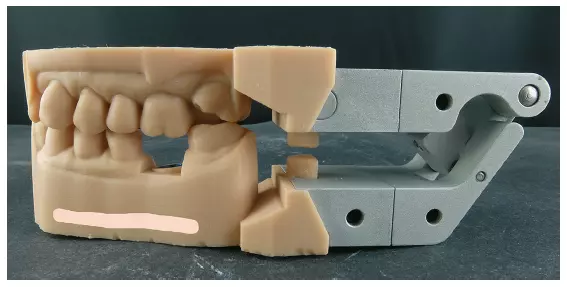 Abb. 44: Als Modellhalter hat sich der 3Shape-Halter bewährt. Trotz des relativ hohen Preises war es eine lohnende Anschaffung für uns. Daneben bewährt sich nach wie vor das herkömmliche Einartikulieren.