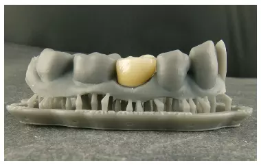 Abb. 59: Den „CoreFile“-Datensatz von Atlantis haben wir mit unserem Formlabs-Drucker als Kontrollmodell gedruckt.