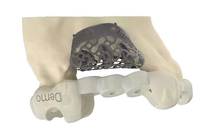 4. Schritt