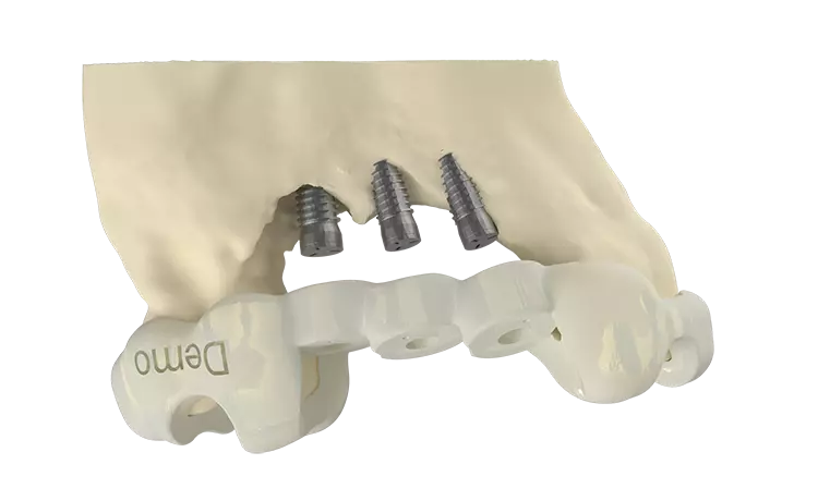 3. Schritt