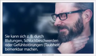 In Deutschland erkranken jährlich etwa 10.000 Menschen neu an Mundhöhlenkarzinomen.