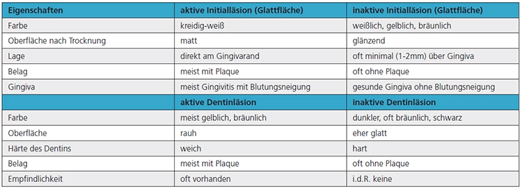 Tab. 4: Unterscheidungsmerkmale von aktiver vs. inaktiver Initialkaries an Glattflächen und aktiver und inaktiver Dentinkaries.