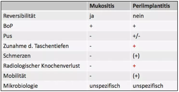 Tab. 1: Diagnosekriterien Mukositis vs. Periimplantitis nach AWMF-Leitlinie „Die Behandlung periimplantärer Infektionen an Zahnimplantaten“ [28]. Zunahme der Taschentiefen und radiologischer Knochenverlust als Diagnosekriterien der Periimplantitis (rot markiert).