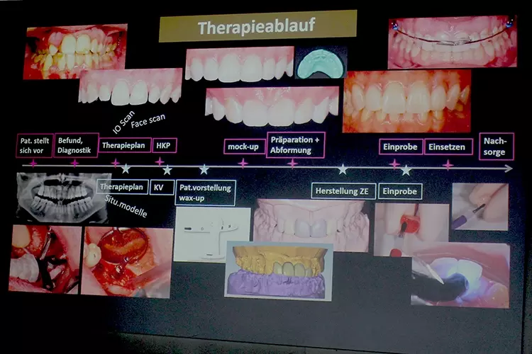 Therapieablauf in Hinblick auf die interdisziplinäre Zusammenarbeit im Team Klink/Votteler