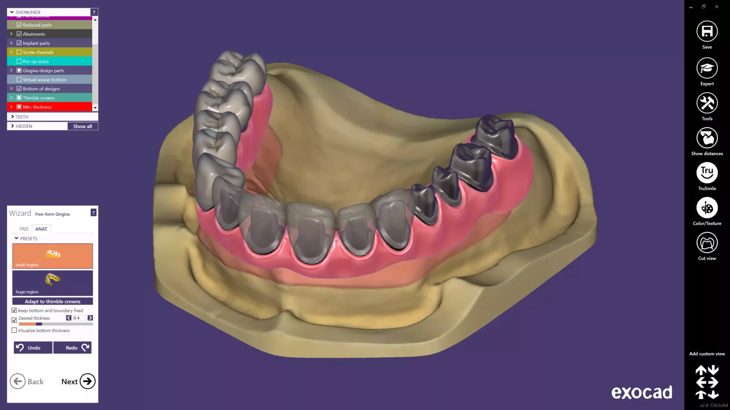 Neu und ab sofort verfügbar: exocad DentalCAD 2.4 Plovdiv | Dentalwelt