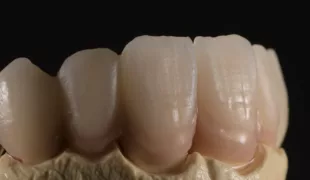 Sorgfältig bearbeitete Oberfläche