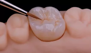 .