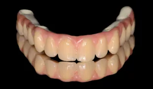 Das CAD/CAM-Material TRINIA wurde umfassend getestet und hat eine hohe Biokompatibilität.