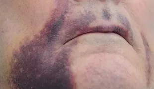 .
