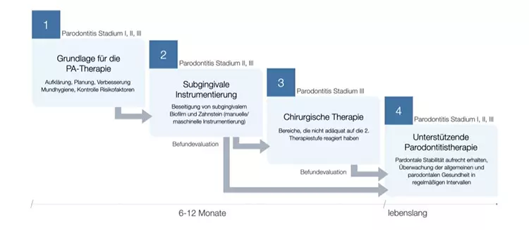 Der Stufenplan der Parodontaltherapie gliedert sich in die ersten 3 aktiven Phasen sowie die lebenslange unterstützende Therapiephase.