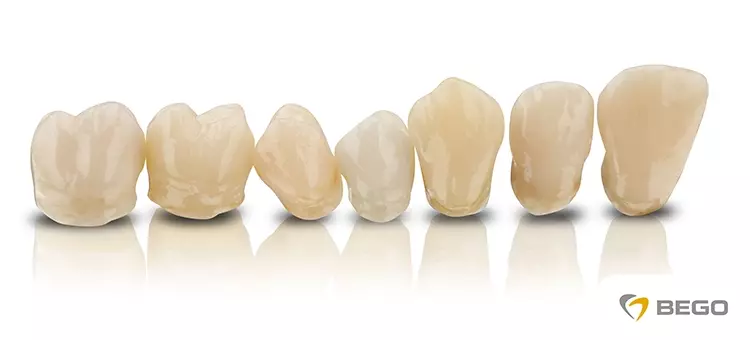 BEGOs branchenführende 3D-Druckmaterialien sind künftig auch für Rapid Shape
Drucker erhältlich.
