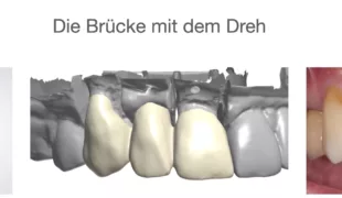 „Die Brücke mit dem Dreh“ – Impressionen aus dem Gewinnervideo des Filmfestivals 2020 von ZT Reinhard Busch, Universität Kiel.