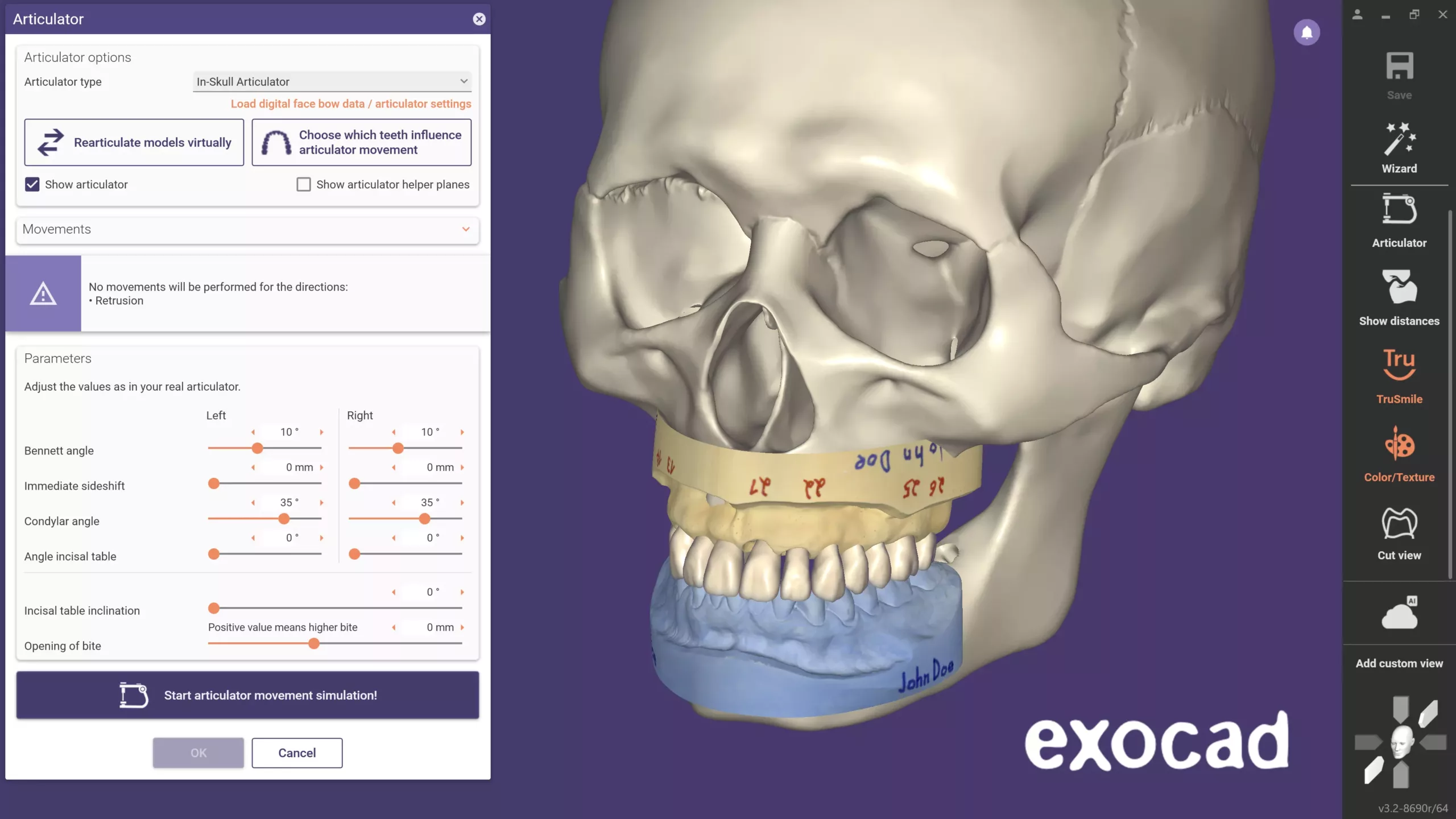 Der neue Virtuelle Artikulator unterstützt Gamma Dental Reference SL, Kavo PROTARevo 5B sowie die Artikulatorvisualisierung in einem anatomischen Schädelmodell.