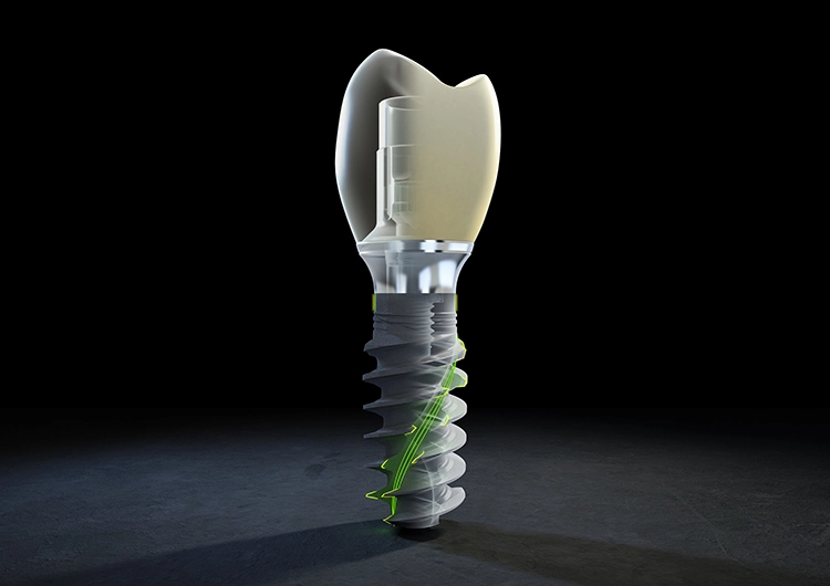 Das neue TLX System ist ab September 2021 am Markt verfügbar.