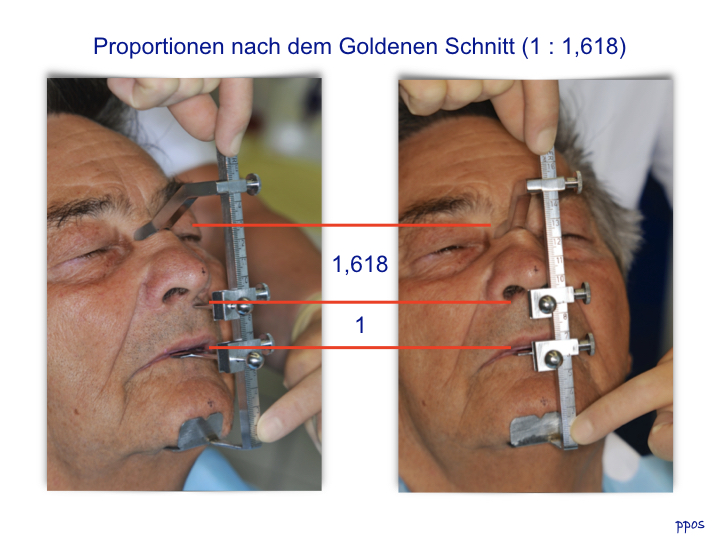 Abb. 5: Darstellung der Abmessungen der Gesichtsproportionen mit dem Goldenen Schnitt.