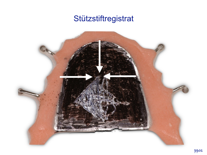 Abb. 7b: Trotz mehrfachen Übens war das Schreiben eines klaren Pfeiles nicht möglich. Die Umhüllende aller Schreibbahnen ist ein Rhombus, dessen Spitze die zentrische Position darstellt.