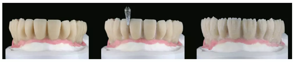 Abb. 14: Rationelles Cut-back.