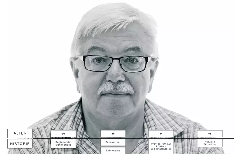 Abb. 1b: Die dentale Historie des Patienten wird erfasst, bevor es an die Planung des neuen Zahnersatzes geht.