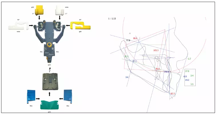Abb. 6: Die ausgewerteten Axiodaten zur Programmierung des Artikulators.