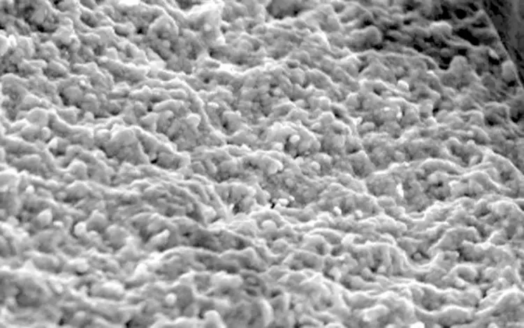 Abb. 1: die Oberfläche eines rauen Patent™ Implantats.