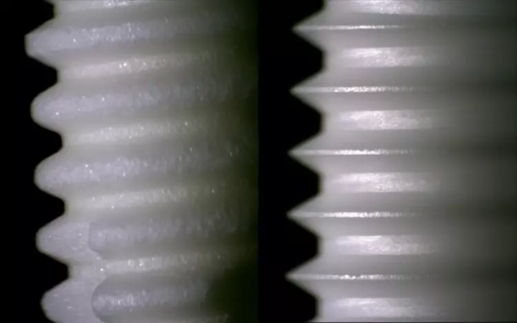 Abb. 3: beide Implantate im direkten Vergleich.