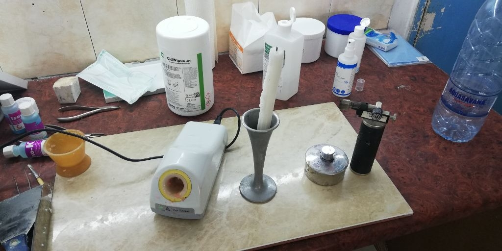 Hospital in Siavonga: Hier gibt es schon ein kleines zahntechnisches Labor. Die Kerze, der kleine Brenner und das Spiritusflämmchen gab es  vor Ort um Wachs zu erhitzen. Gut, dass ich einen Induktionsbrenner aus Deutschland mitgebracht habe.