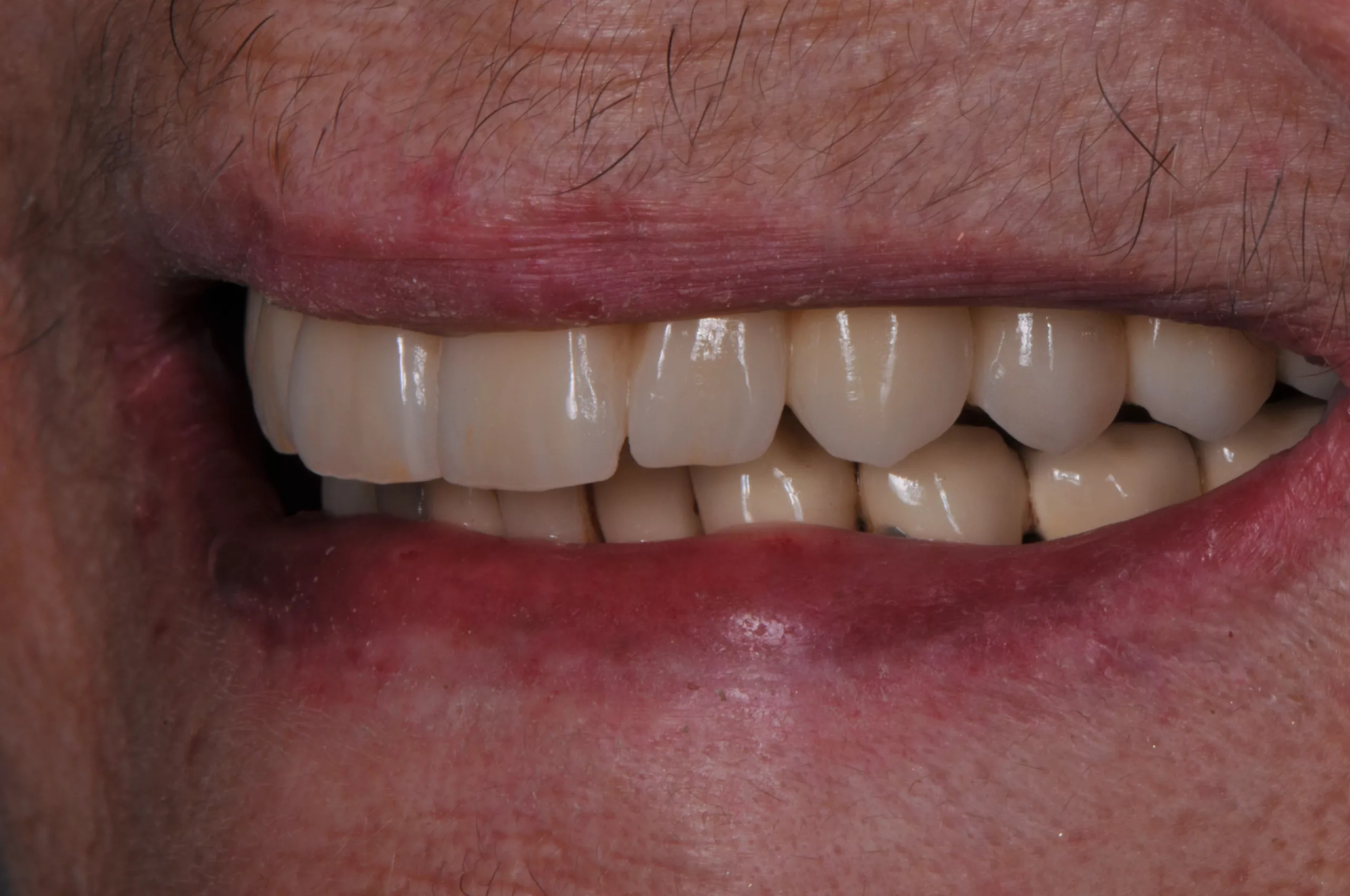 Abb. 16: Harmonisches Lippenbild.
