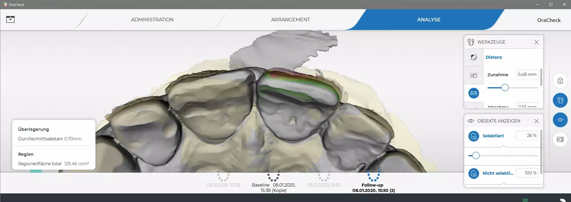 Abb. 10: OraCheck-Analyse nach Frontzzahntrauma mit Reposition des luxierten Zahnes im Vergleich zum Ausgangszustand vor dem Unfall.