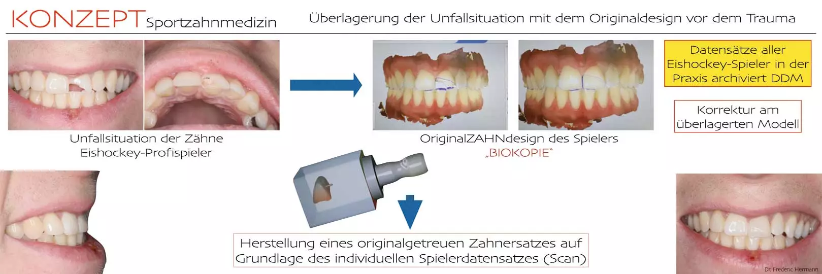 Abb. 11: Konzept Sportzahnmedizin (Biokopie Sport nach Hermann F.).