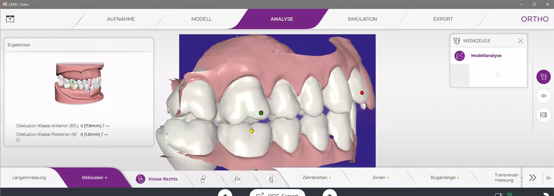 Abb. 7: KFO-Analyse mit der CEREC Ortho-Software.