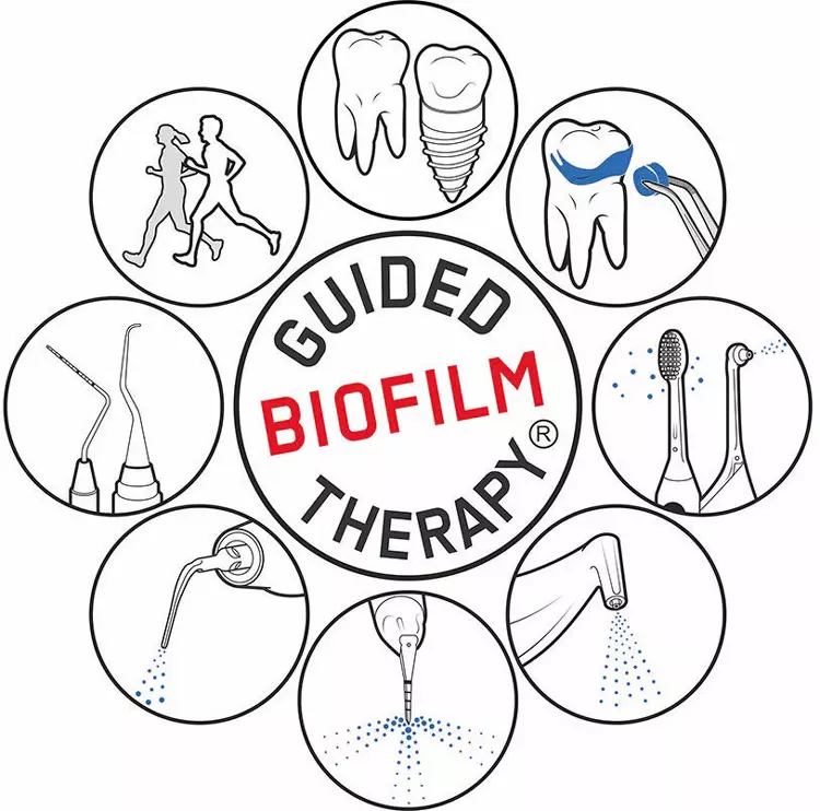 Abb. 4: Guided Biofilm Therapy® (EMS).