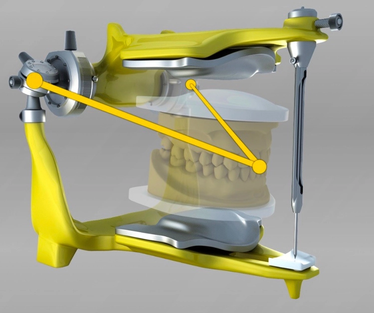 Aufbau des virtuellen Artikulators nach mittleren Werten in der Cerec-Software, die sich individualisieren lassen. Damit wird die funktionelle Okklusion an den Anfang der Prozesskette gestellt.
