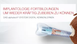 Anwender erhalten Tipps und Tricks für die geführte Implantation mit dem alphatech® guided surgery System.