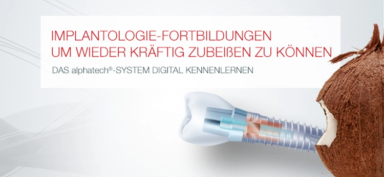 Anwender erhalten Tipps und Tricks für die geführte Implantation mit dem alphatech® guided surgery System.