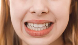 .