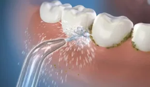 .