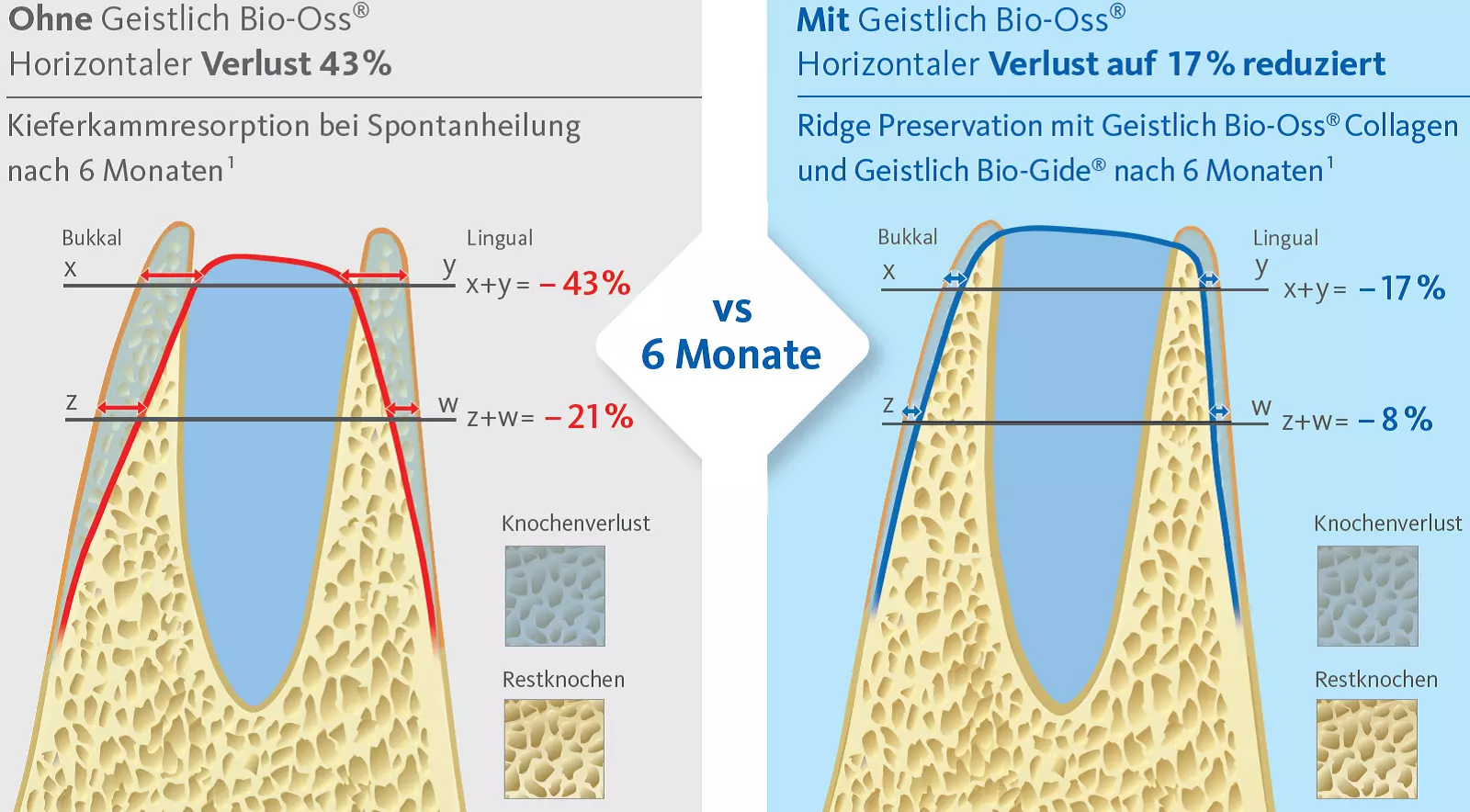 Kieferkamm-erhaltende Maßnahme und Spontanheilung im Vergleich: Jung RE, et al. J Clin Periodontol. 20133 Jan; 40 (1):90-8.