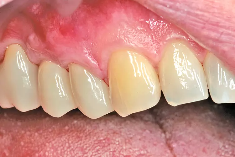 Abb. 4: Endergebnis nach der PZR.