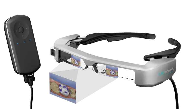 Das eyeCADconnect-System unterstützt den Zahnarzt beim digitalen Abformen mit dem Intraoralscanner – mit dem Ergebnis exakter, schnellerer und effizienterer Scans.