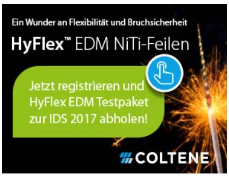 Die HyFlex EDM Feile von Coltene darf getestet werden.