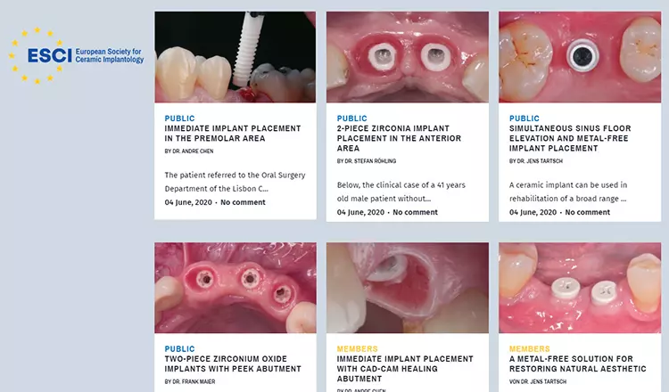 Die neuesten Fallberichte zu Keramikimplantaten.