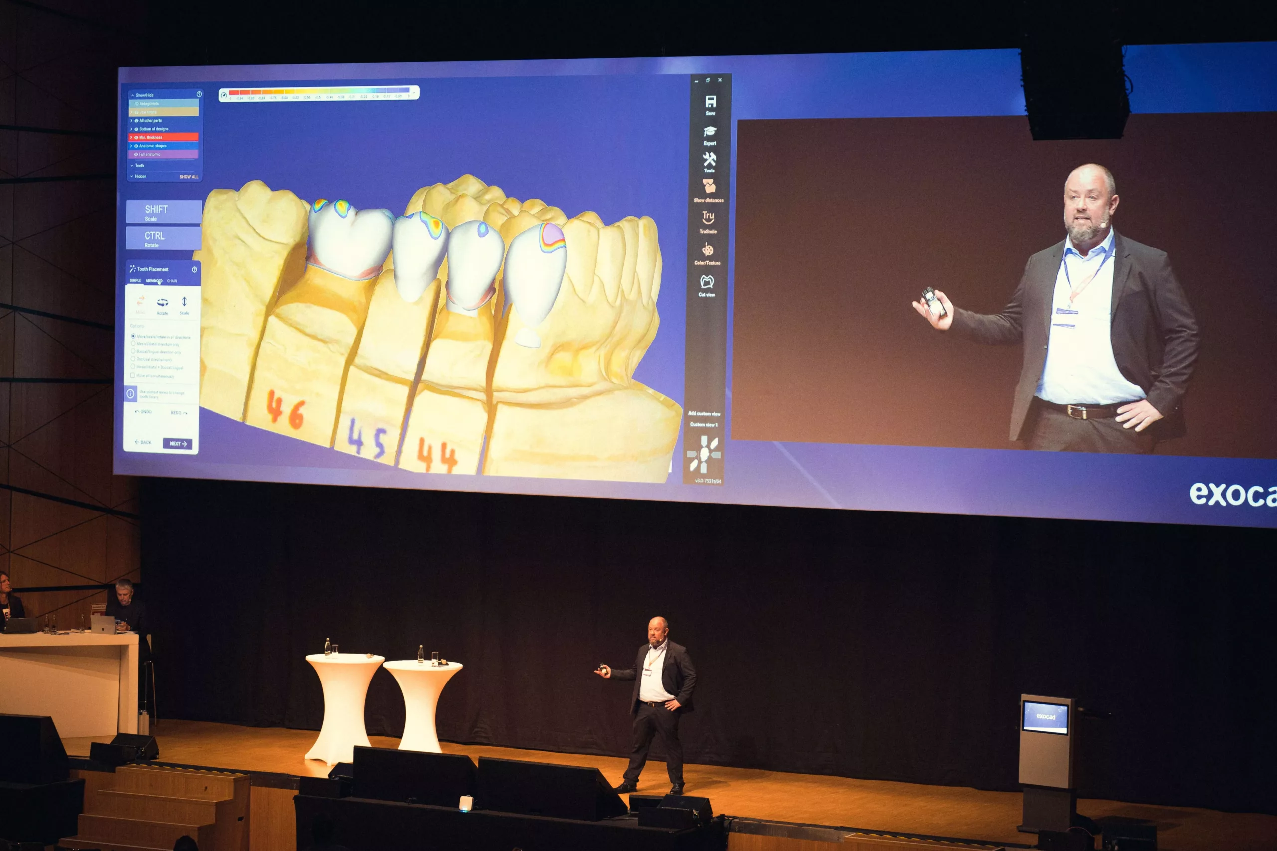 Die Teilnehmer erlebten bei exocad Insights 2020 eine Weltpremiere: Michael Kohnen, Leiter Global Application Support bei exocad, präsentierte die neuen Features der kommenden Software-Releases Galway für DentalCAD, eine der weltweit führenden Softwarelösungen für Labore, und für exoplan, die offene Implantatplanungssoftware von exocad.