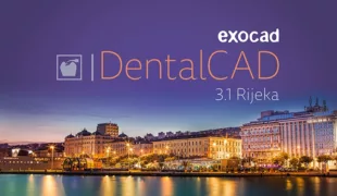 DentalCAD 3.1 Rijeka: verkürzt die Designzeiten bei Einzelzahnrestaurationen, vereinfacht das anatomische Freiformen und bietet hoch automatisierte präoperative Workflows.